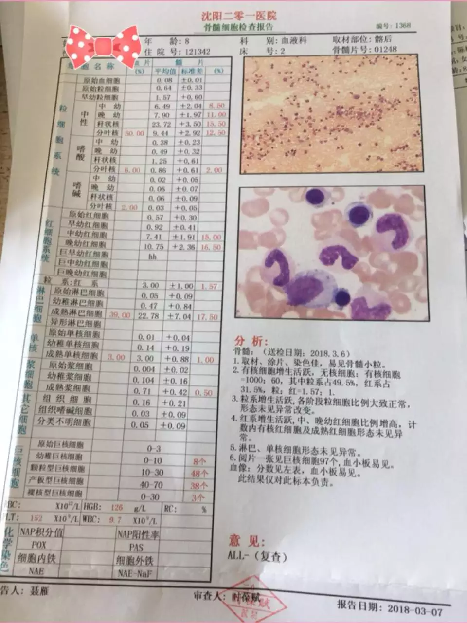 3、淋巴细胞百分比71.6它会是白血病吗