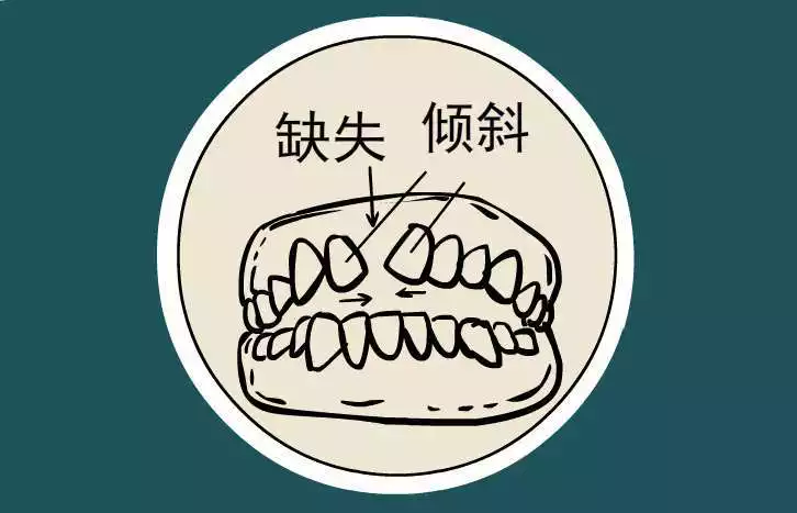 4、我爸昨天晚上梦见下牙掉了预示什么