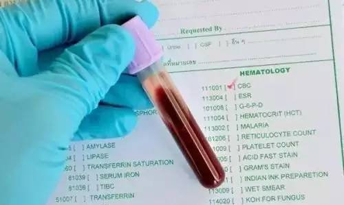 3、查血验男女准不准？