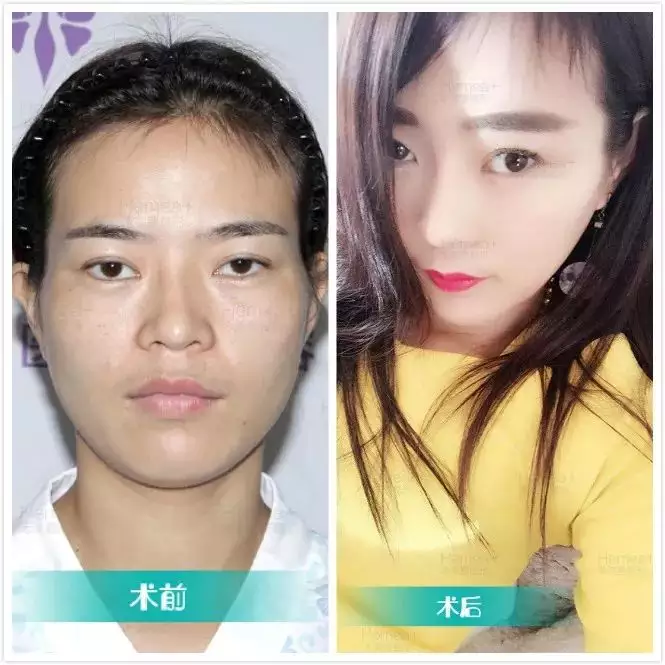 3、有人说女人的太阳穴部位凹进去命不好,婚姻不幸是吗