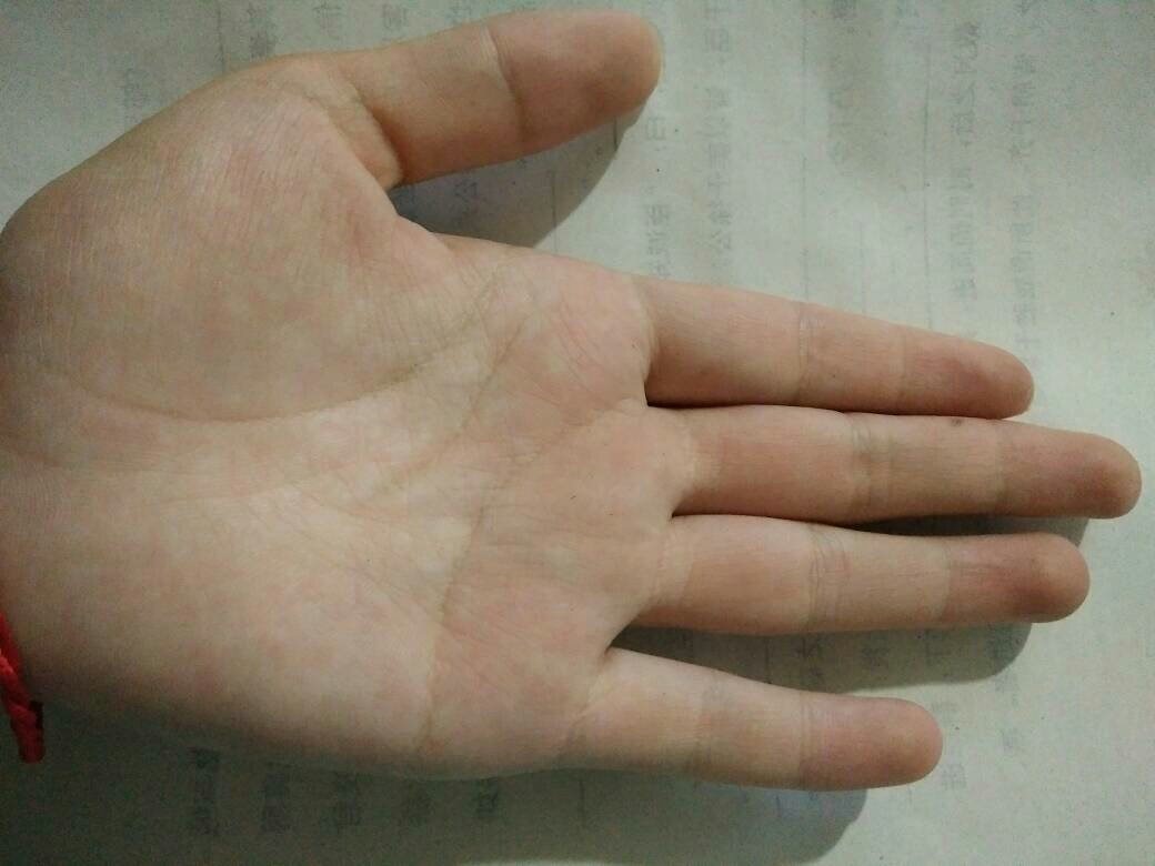 2、我是女生,为什么我的双手都是川字形的掌纹,怎么跟别人的不一样?
