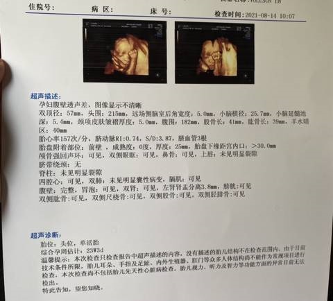 2、胎宝宝的四维彩超照片很丑，是不是出生后也会很丑？