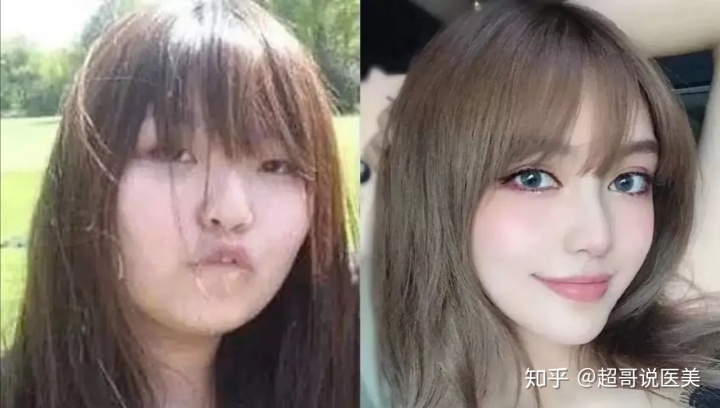 2、从斤瘦到90斤会有明显不同么？样貌会变化一些么