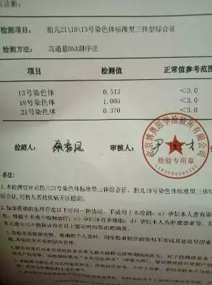 4、无创dna检查 能看出男女吗