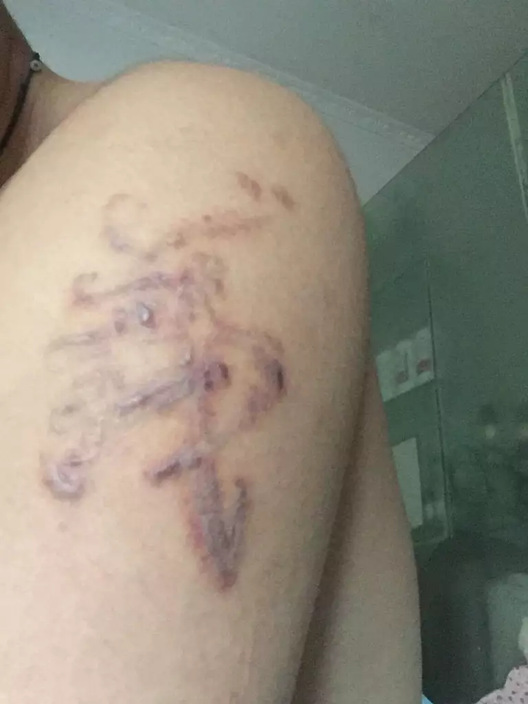 4、纹身真的会有扛不住吗，我觉得一点