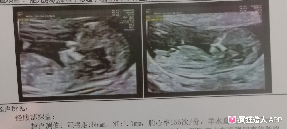 2、python分治法求二维数组局部峰值方法