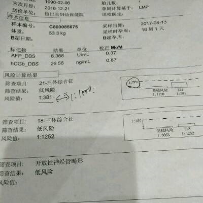 2、无创DNA检测,可以看孩子性别吗?据说 21,18,13 这三个值之间,18的值比21和13都低,就是反之女宝!