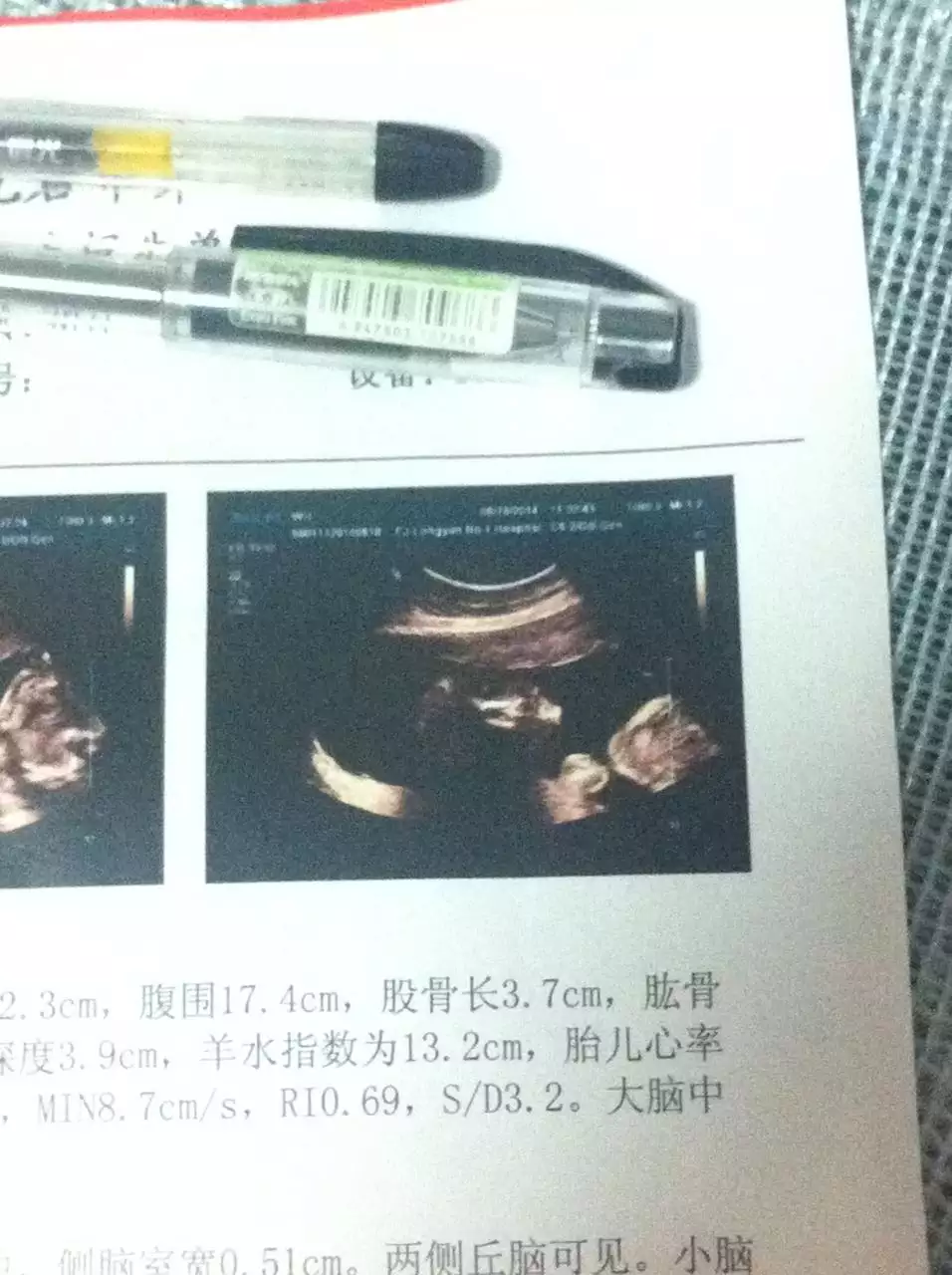 3、七个月四维彩超图片，看下是男孩女孩？