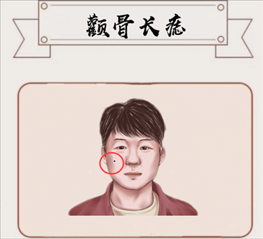 2、男生脸上的痣