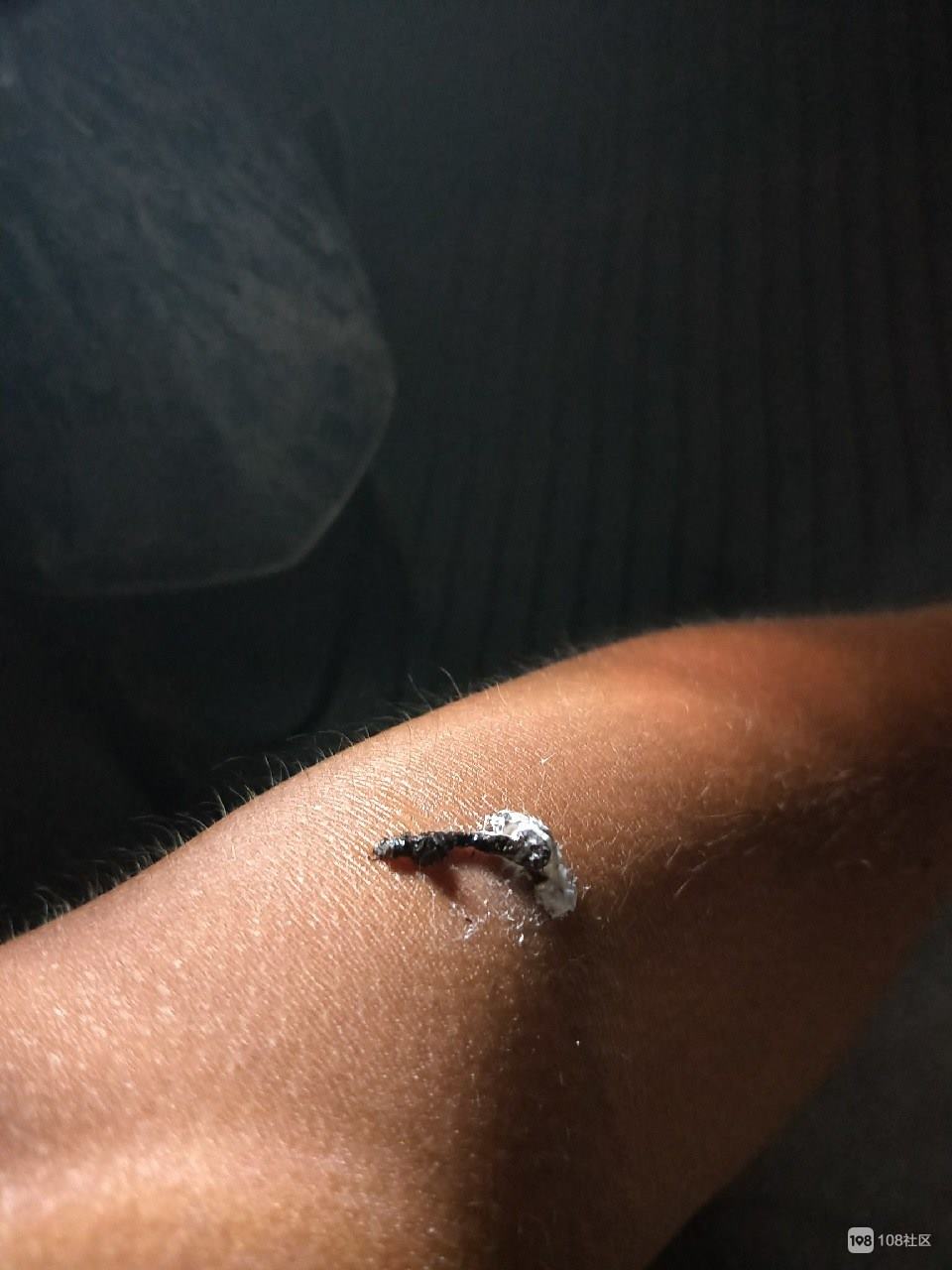 2、鸟粪掉衣服上十大征兆？