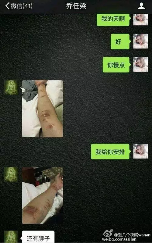 4、乔任梁到底为什么死？还是他杀？没了胳膊是怎么回事？井柏然因此退出微博，很多人骂他，为什么？