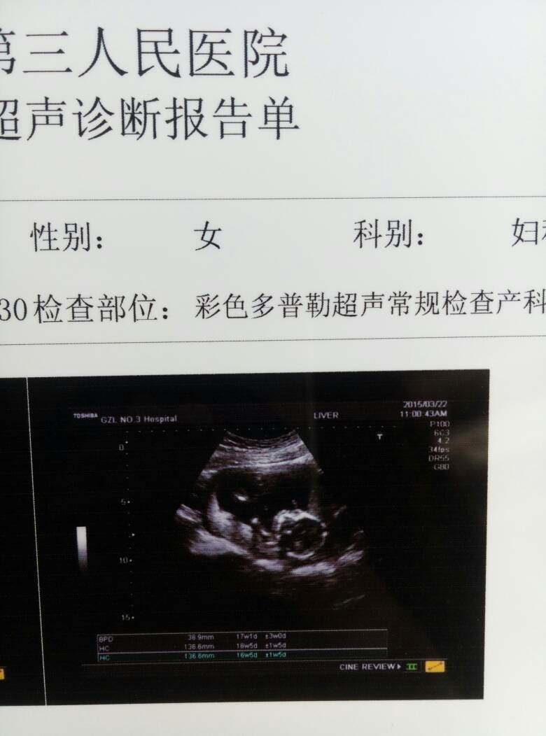 2、怀男孩4个月b超单图片是什么样子呢？
