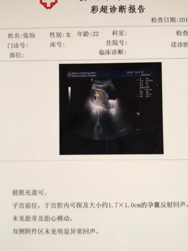 3、怀孕了差不多6个月查了是女儿，有可能是儿子吗