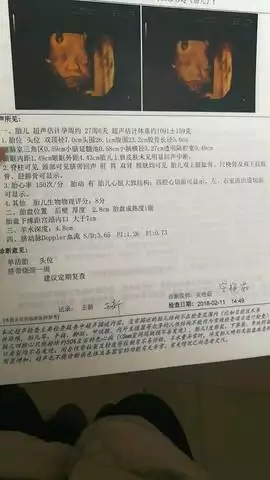 4、六个月女翻男的概率是多少