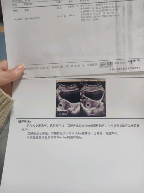 2、怀男孩4个月b超单图片是什么样子呢？