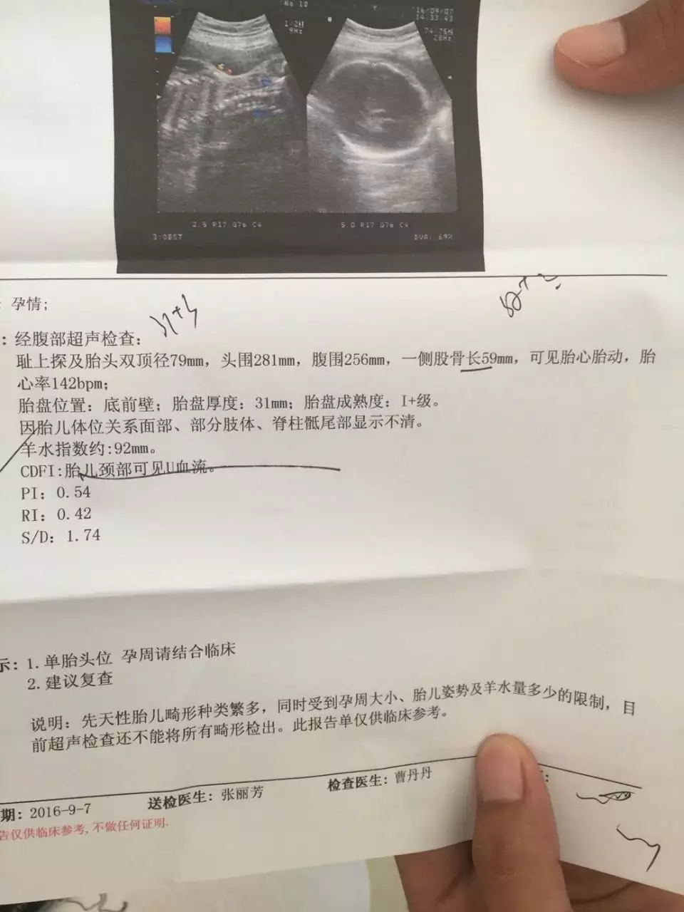 3、检测母亲y用来判断是男是女需.