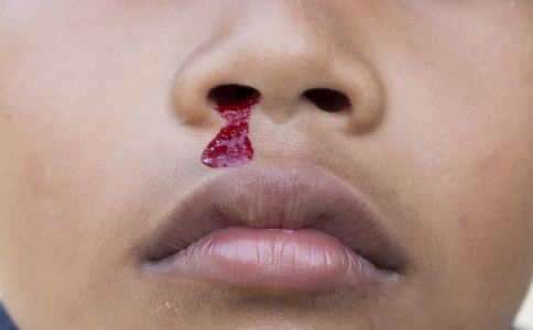 2、儿童白血病的症状，你有哪些了解呢？