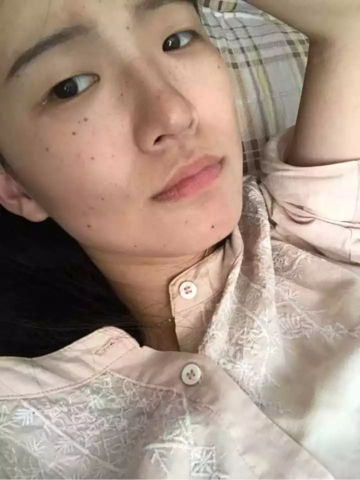 4、女人脸上哪些痣不能动？