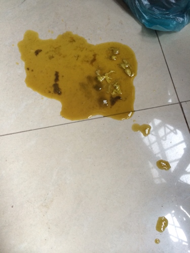 2、人在临死前,把排净后还能活几天?