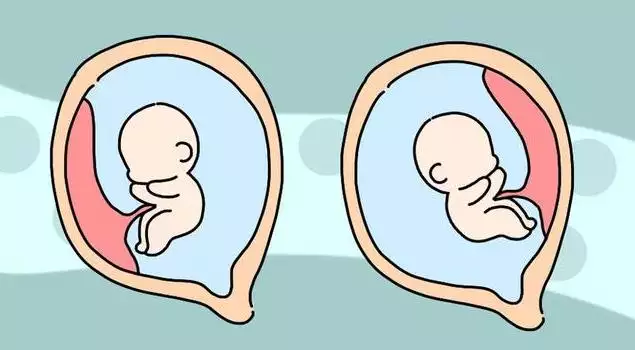 3、怀儿子真的会逢赌必输吗