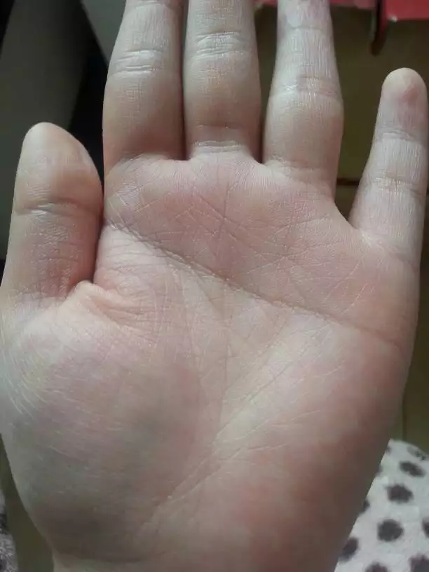 3、手掌的三条线正确图解